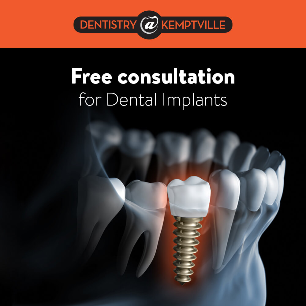 Go 5 Facts You Need to Know about Dental Implants in Kemptville
